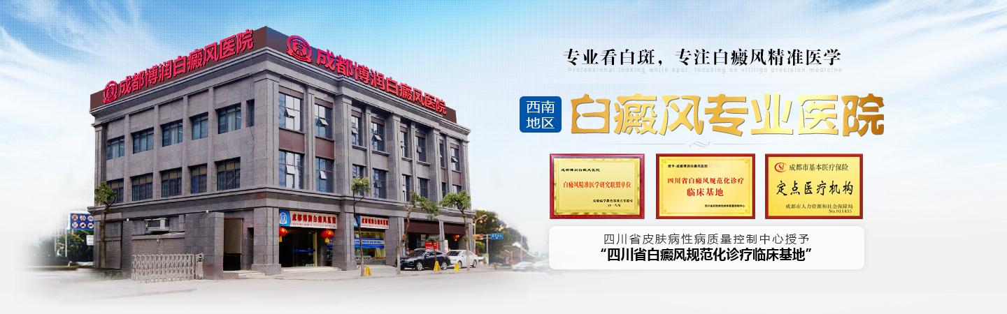 成都白癜风